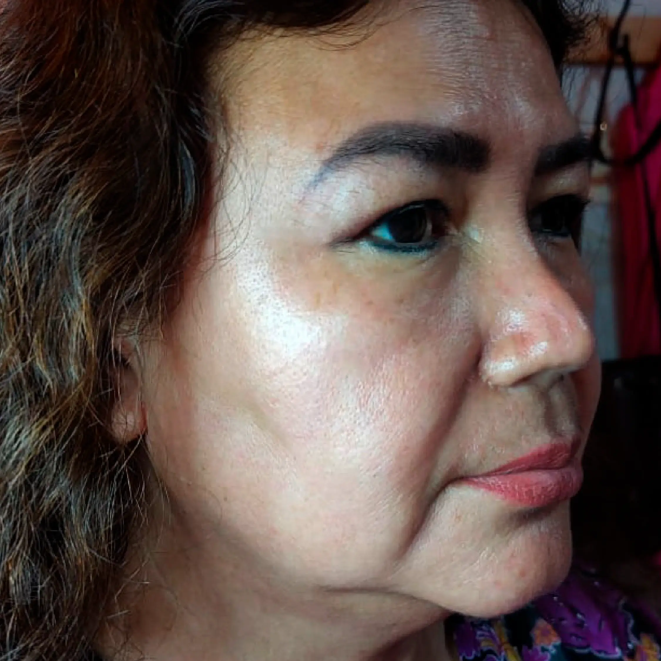 Img jhl center tratamientos