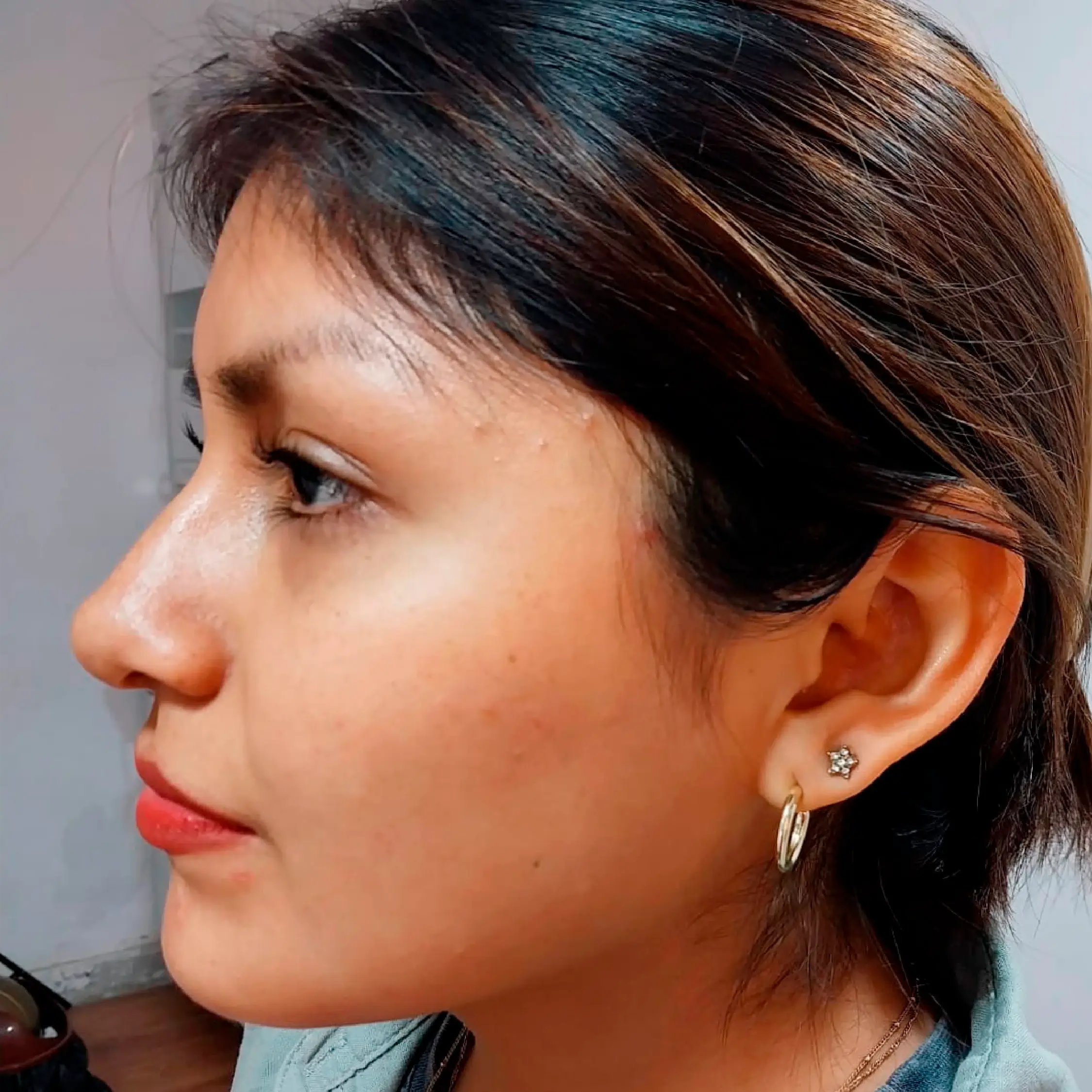 Img jhl center tratamientos